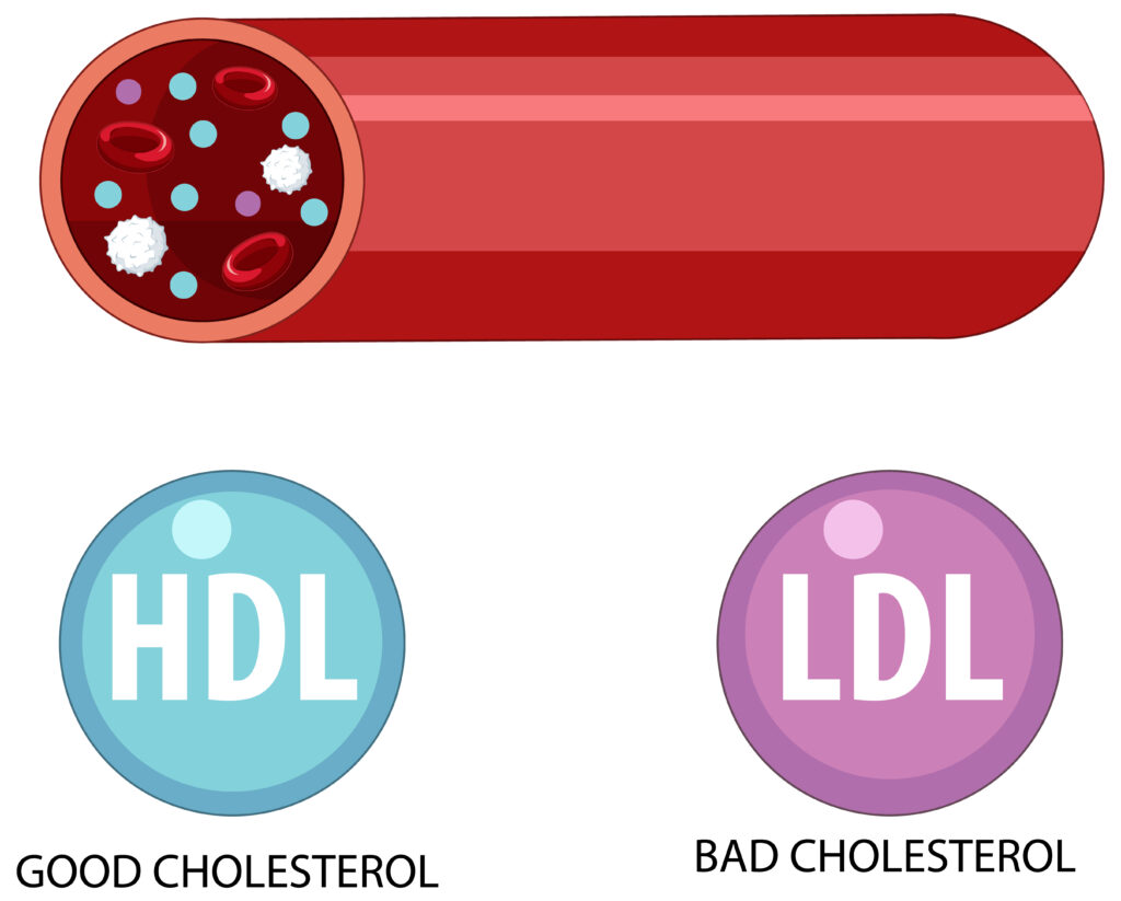 Types of Cholesterol HDL and LDL illustration